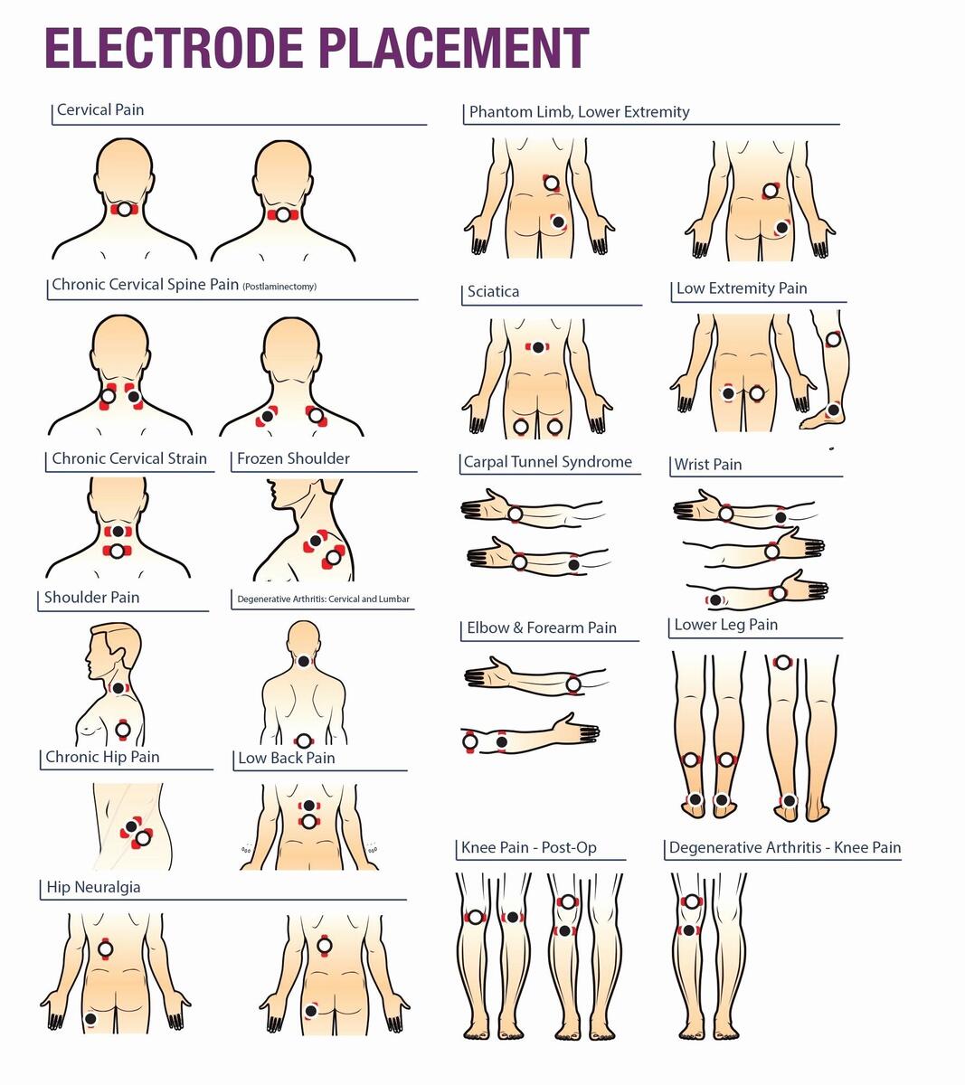 15 Tens Unit Pad Placement Ideas To Save Today Ten Unit Tens Unit Pads Tens And Units And More