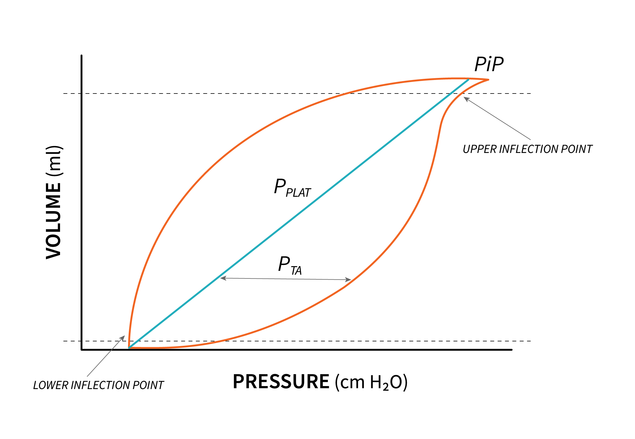 8 6 Patient Ventilator Interaction Graphic Representation Of Ventilation Breathe Easy RT Student Resource For Mechanical Ventilation