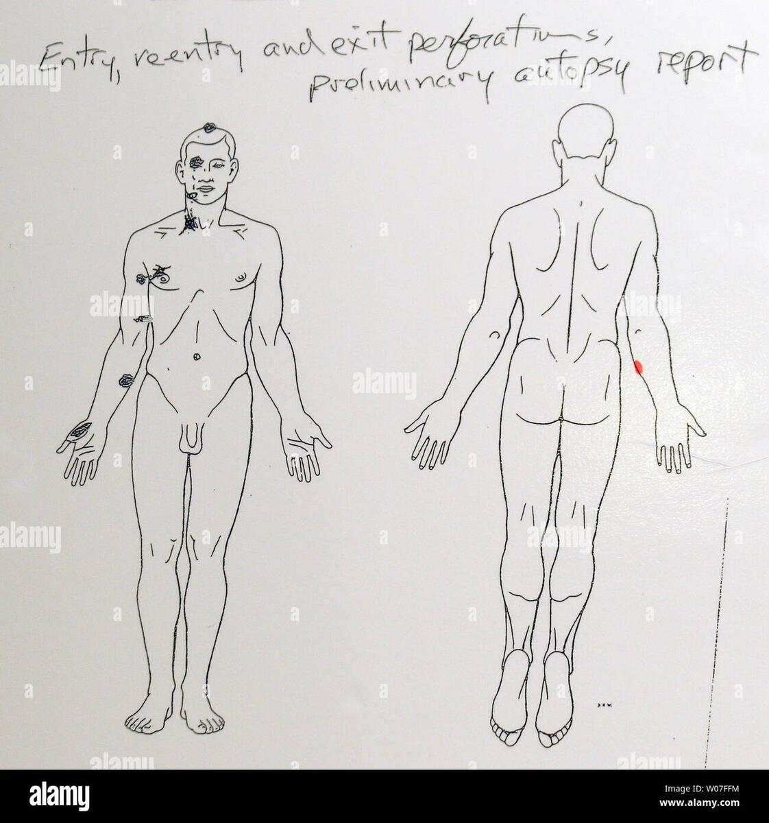 A Preliminary Autopsy Report On Michael Brown Was Disclosed At A Press Conference In Ferguson Missouri On August 18 2014 Dr Michael M Baden The Former Chief Medical Examiner For The City