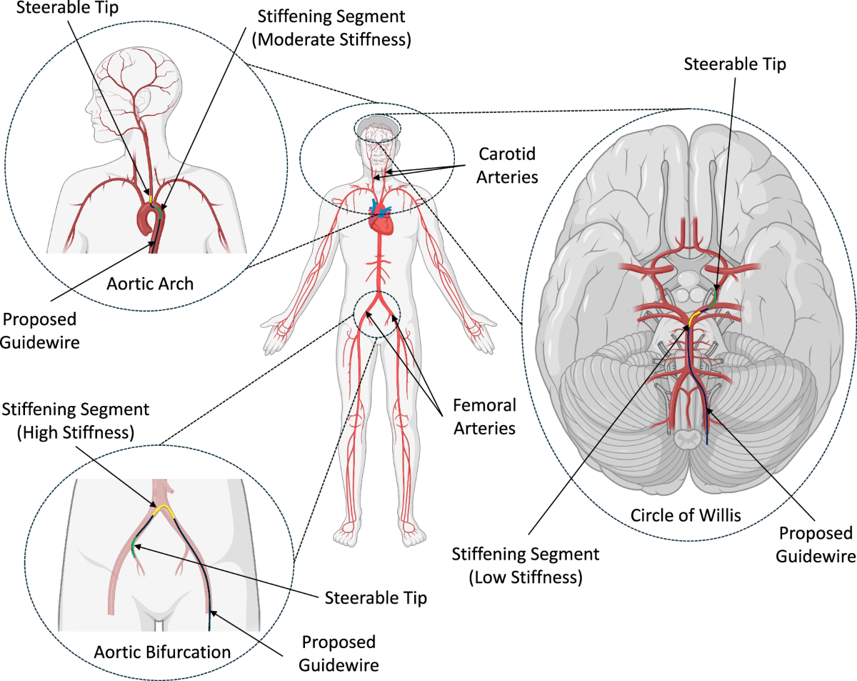 A Variable Stiffness Robotically Steerable Guidewire For Endovascular Interventions Npj Robotics