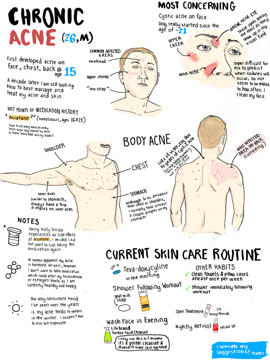 Acne Any Advice On Addressing Chronic Face And Body Acne Here Is A Small Explanation Of My Case And I Appreciate Hearing Any Opinions Or Similar Experiences Thanks R SkincareAddiction