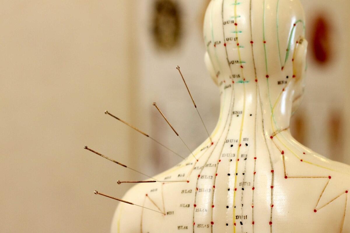Acupuncture Points Charts And Meanings Won Institute