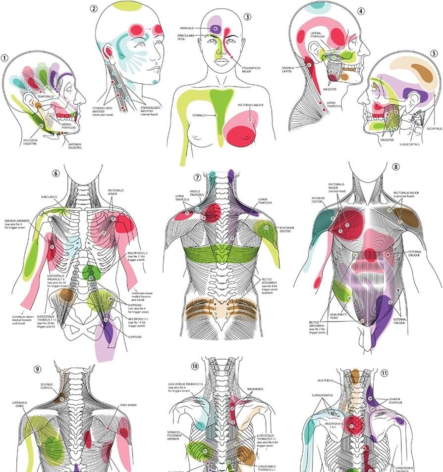 Amazon Anatomy Lab Trigger Points I Poster LAMINATED Anatomy And Physiology Trigger Points Poster 17 3 X 22 5 Inches Trigger Points Anatomy Poster Industrial Scientific Amazon Anatomy Lab Trigger Points I Poster LAMINATED Anatomy And Physiology Trigger Points Poster 17 3 X 22 5 Inches Trigger Points Anatomy Poster Industrial Scientific