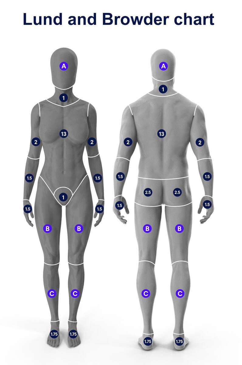 Burn Wound Depth Assessment Classification Basics Of Burn Care