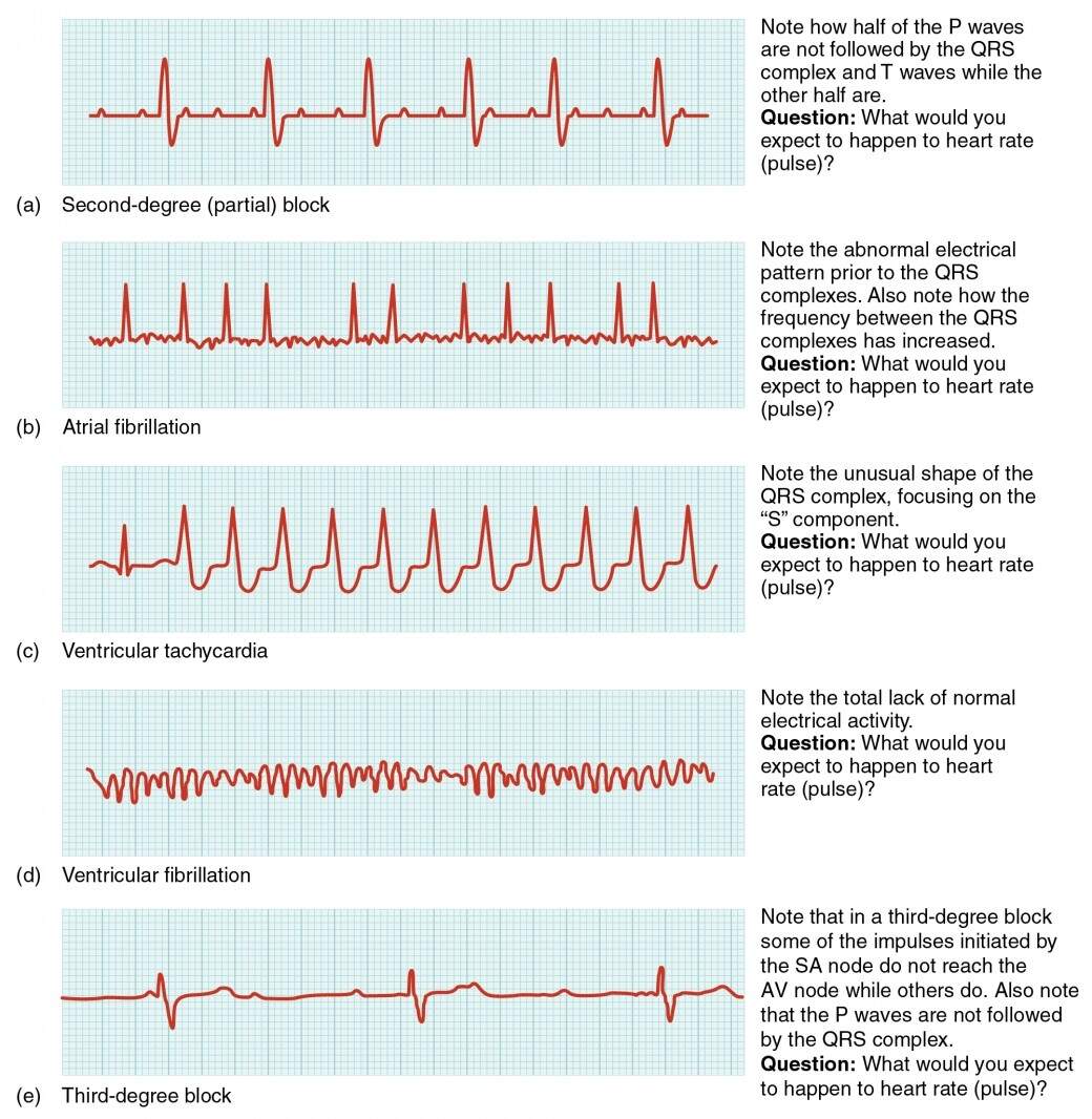Cardiac Muscle And Electrical Activity Anatomy And Physiology II
