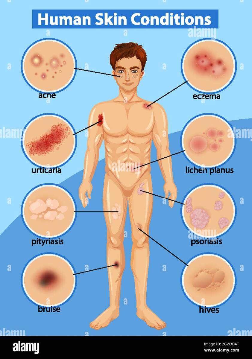 Diagram Showing Differen Human Skin Conditions Stock Vector Image Art Alamy