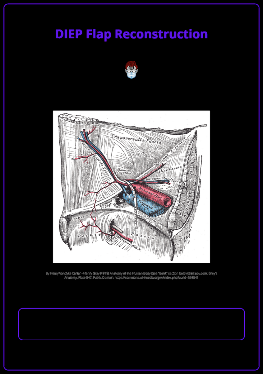 DIEP Flap Reconstruction Anatomy Key Surgical Steps Complications DIEP Flap Reconstruction Anatomy Key Surgical Steps Complications