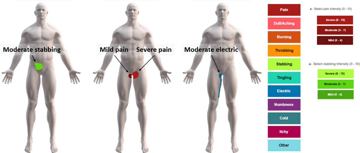Digital Body Mapping Of Pain Quality And Distribution In Athletes With Longstanding Groin Pain Scientific Reports