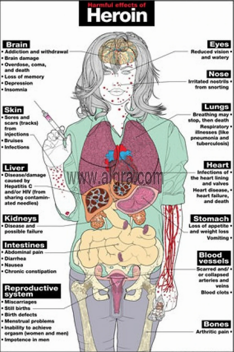 Effects Of Heroin Or Other Opiates Recovery Unconventional