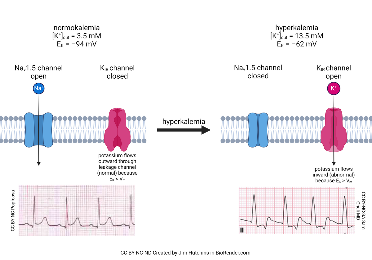 Cardiac Muscle And Electrical Activity Anatomy And Physiology II