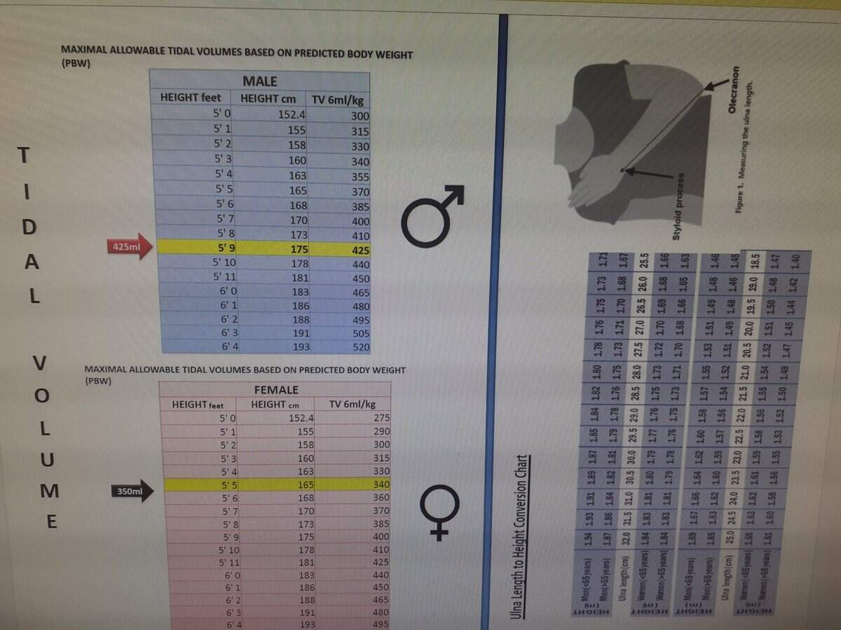 EM ICU Ventilation Training Revising The ARDSNet Ventilationstrategy Calculate PREDICTED IDEAL BODY WEIGHT Using Height Equation TopTip Ulnar Length Predicts Height Measure From Styloid Process To Olecranon And Use The Conversion Chart