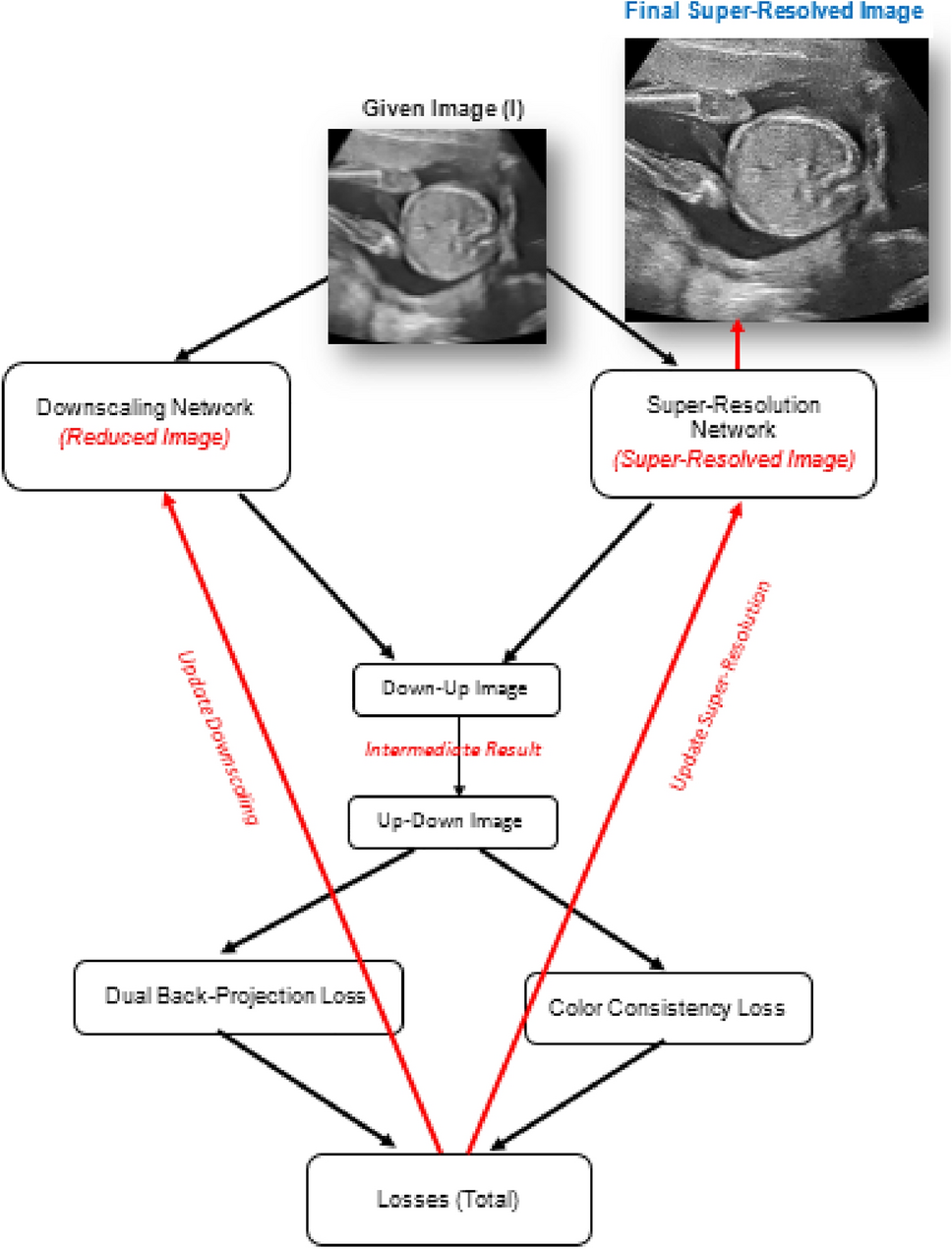 Enhancing Fetal Ultrasound Image Quality And Anatomical Plane Recognition In Low Resource Settings Using Super Resolution Models Scientific Reports