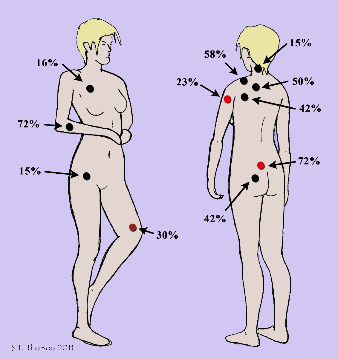 Fibromyalgia Diagnosis How To Advance Your Care American Fibromyalgia Syndrome Association AFSA Fibromyalgia Diagnosis How To Advance Your Care American Fibromyalgia Syndrome Association AFSA