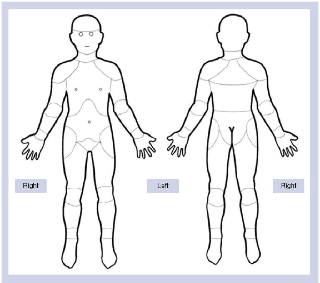 Figure 1 From Pain Charts Body Maps Or Manikins In Assessment Of The Location Of Pediatric Pain Semantic Scholar
