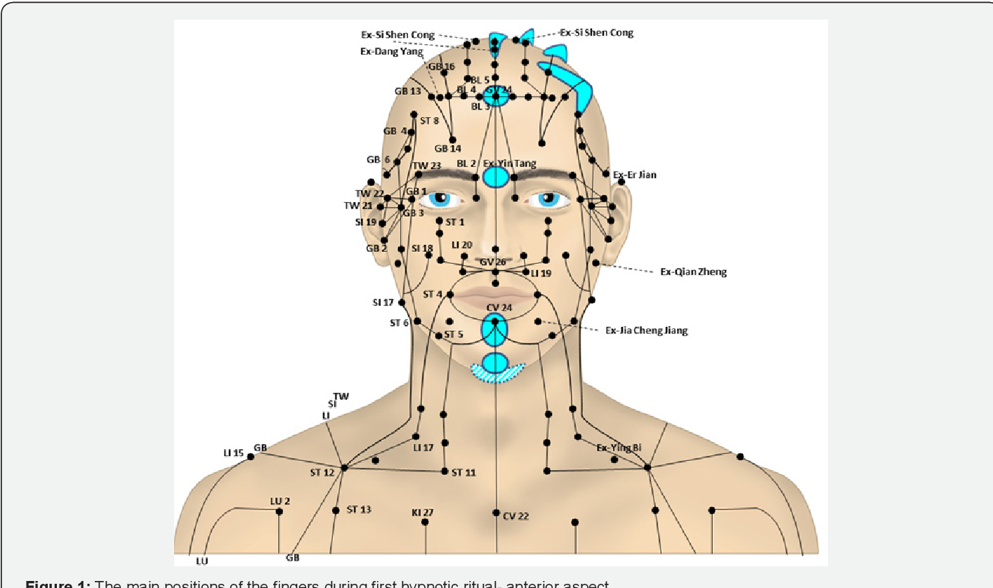 Figure 1 From The Inherent Relationship Between Traditional Chinese Medicine TCM And Hypnotic Rituals Of Awareness Under Conscious Hypnosis AUCH Method Semantic Scholar