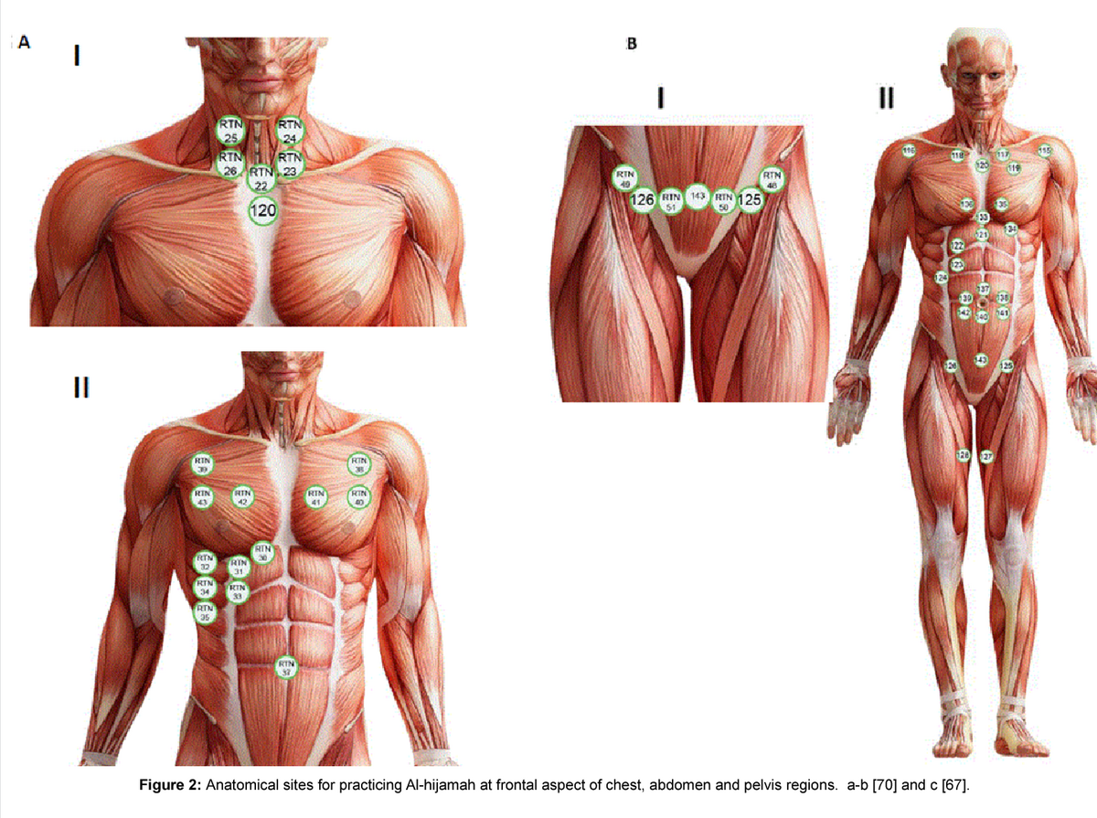 Figure 2 From Anatomical Sites For Practicing Wet Cupping Therapy Al Hijamah In Light Of Modern Medicine And Prophetic Medicine Semantic Scholar Figure 2 From Anatomical Sites For Practicing Wet Cupping Therapy Al Hijamah In Light Of Modern Medicine And Prophetic Medicine Semantic Scholar