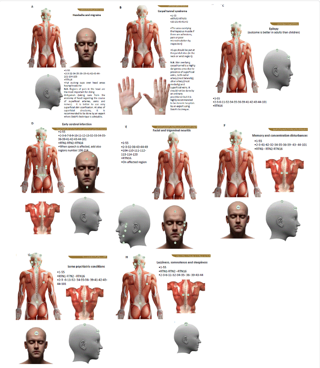 Figure 7 From Anatomical Sites For Practicing Wet Cupping Therapy Al Hijamah In Light Of Modern Medicine And Prophetic Medicine Semantic Scholar Figure 7 From Anatomical Sites For Practicing Wet Cupping Therapy Al Hijamah In Light Of Modern Medicine And Prophetic Medicine Semantic Scholar