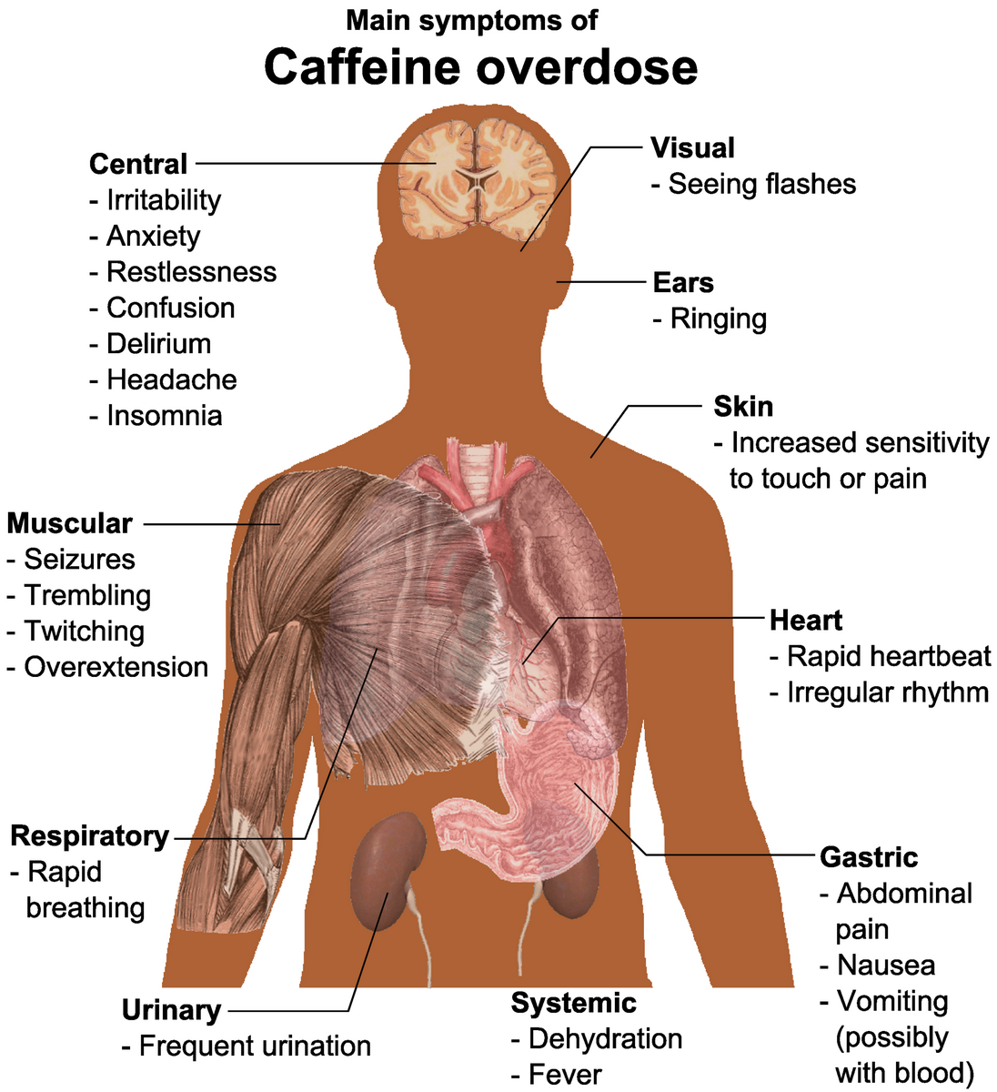 File Main Symptoms Of Caffeine Overdose Png Wikimedia Commons File Main Symptoms Of Caffeine Overdose Png Wikimedia Commons