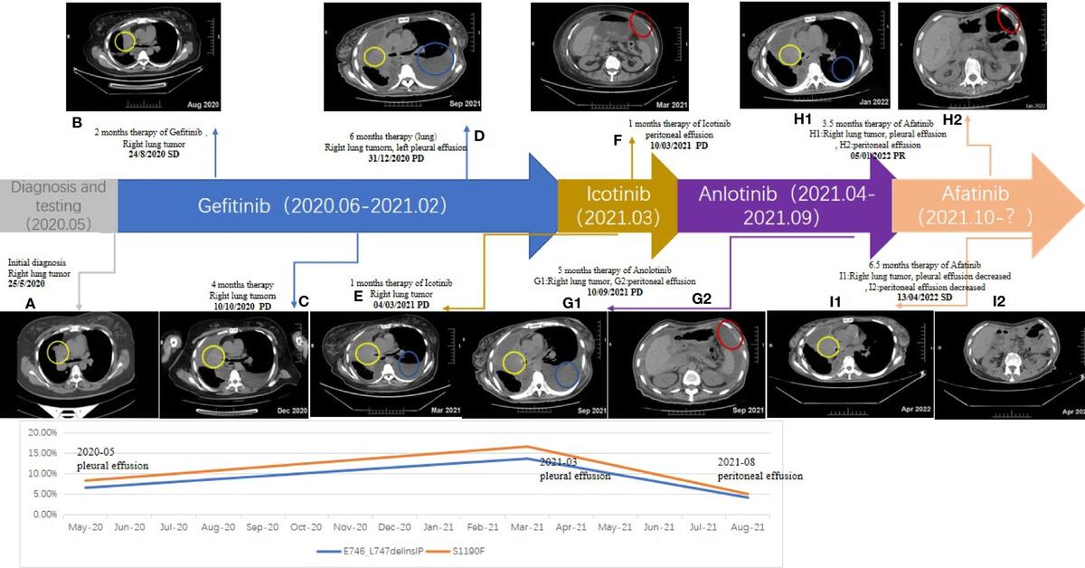 Frontiers Case Report Afatinib Sensitivity In Rare EGFR E746 L747delinsIP Mutated LUAD With Peritoneal Metastases