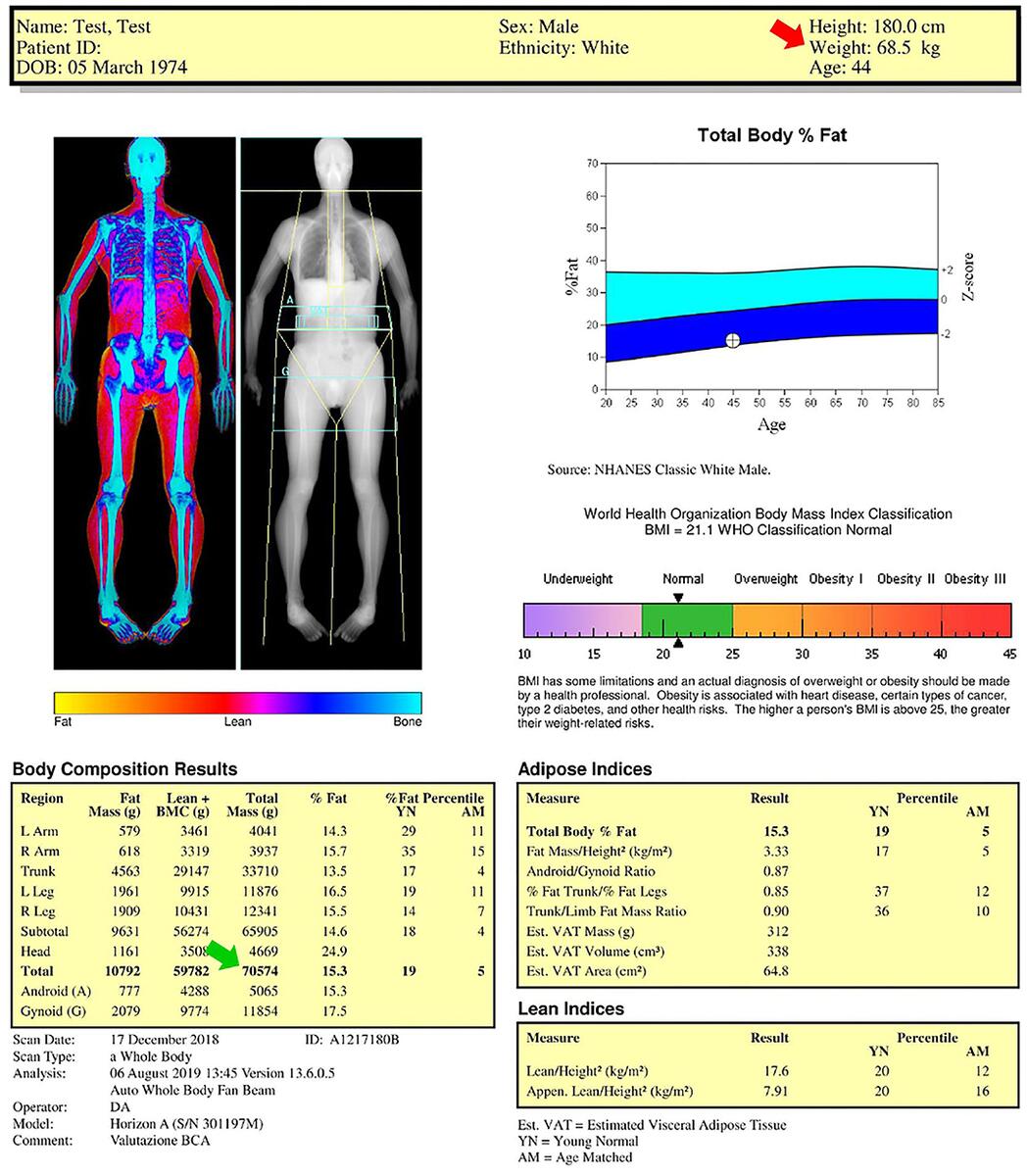 Frontiers DXA Derived Adiposity And Lean Indices For Management Of Cardiometabolic And Musculoskeletal Frailty Data Interpretation Tricks And Reporting Tips Frontiers DXA Derived Adiposity And Lean Indices For Management Of Cardiometabolic And Musculoskeletal Frailty Data Interpretation Tricks And Reporting Tips