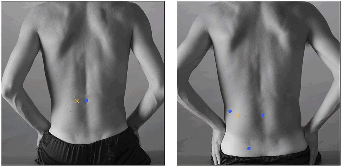 Frontiers Ergonomic Challenges In Healthcare Mapping Physical Load During Patient Transfers Using Electromyographic Field Measurements Frontiers Ergonomic Challenges In Healthcare Mapping Physical Load During Patient Transfers Using Electromyographic Field Measurements