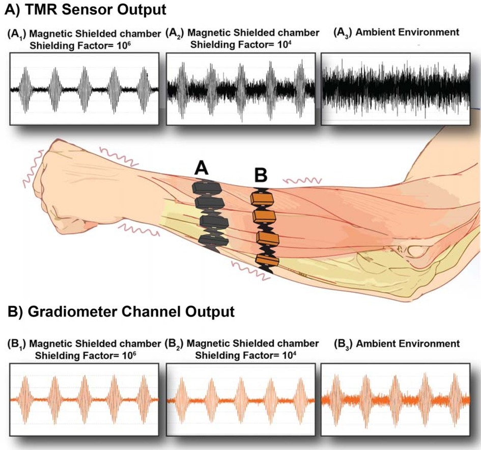 Frontiers Motion Artifact Variability In Biomagnetic Wearable Devices Diagnostics Therapy New Sensors For Biomagnetic Signals PTB De