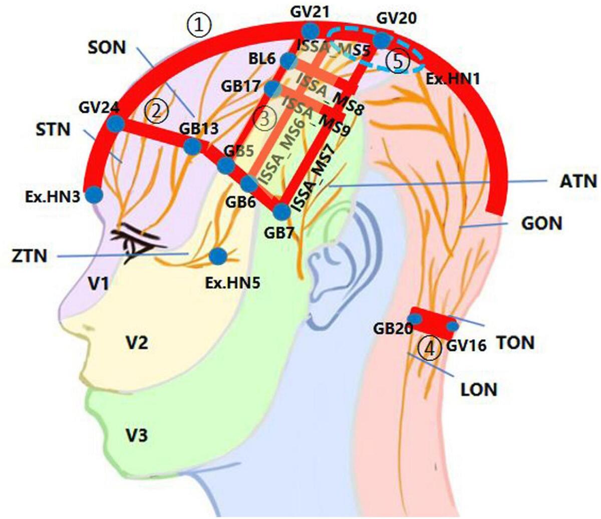 Frontiers Neural Control Of Cerebral Blood Flow Scientific Basis Of Scalp Acupuncture In Treating Brain Diseases Frontiers Neural Control Of Cerebral Blood Flow Scientific Basis Of Scalp Acupuncture In Treating Brain Diseases