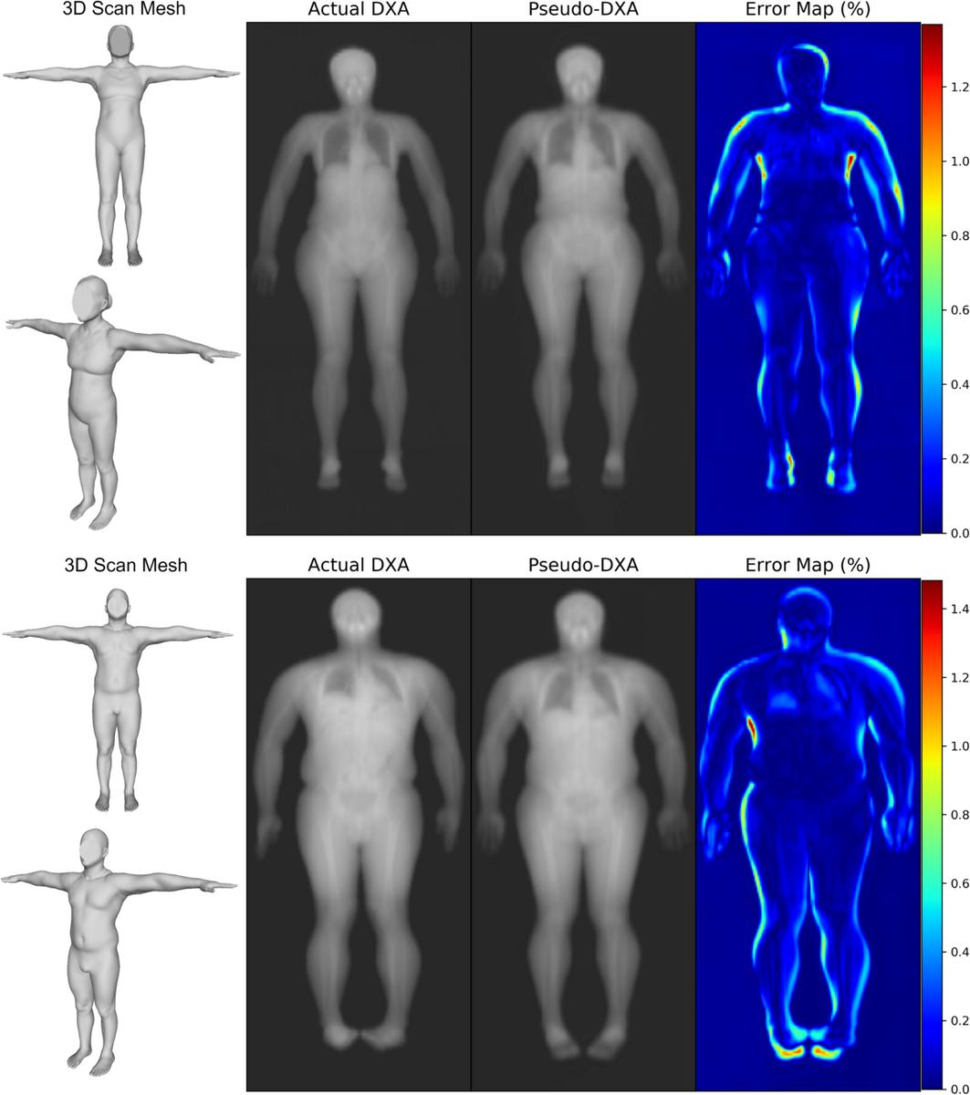 Generative Deep Learning Furthers The Understanding Of Local Distributions Of Fat And Muscle On Body Shape And Health Using 3D Surface Scans Communications Medicine