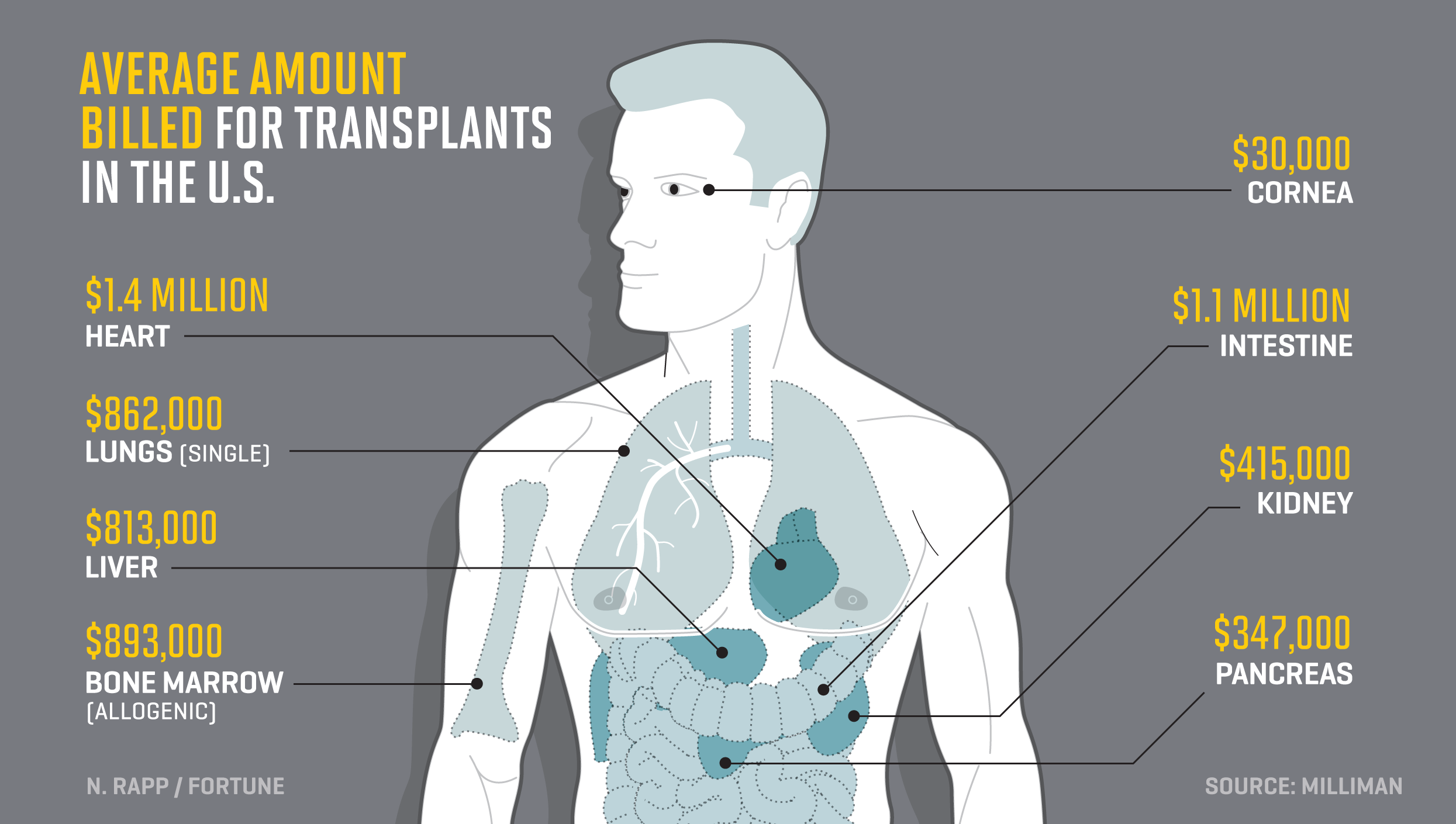 Here S What Every Organ In The Body Would Cost To Transplant Fortune Here S What Every Organ In The Body Would Cost To Transplant Fortune