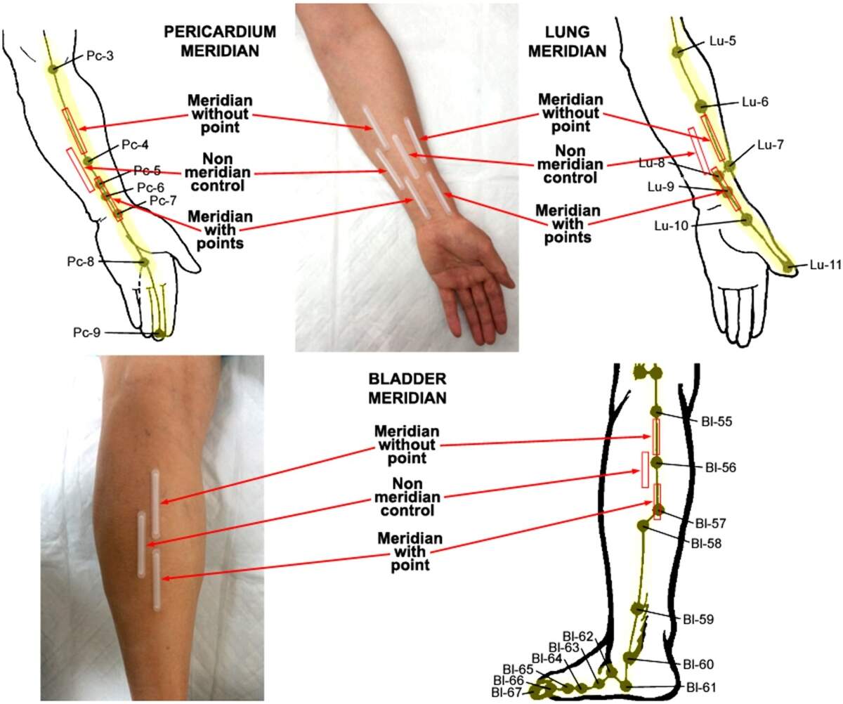 Influence Of Age Gender And Race On Nitric Oxide Release Over Acupuncture Points Meridians Scientific Reports Acupuncture Points Charts And Meanings Won Institute