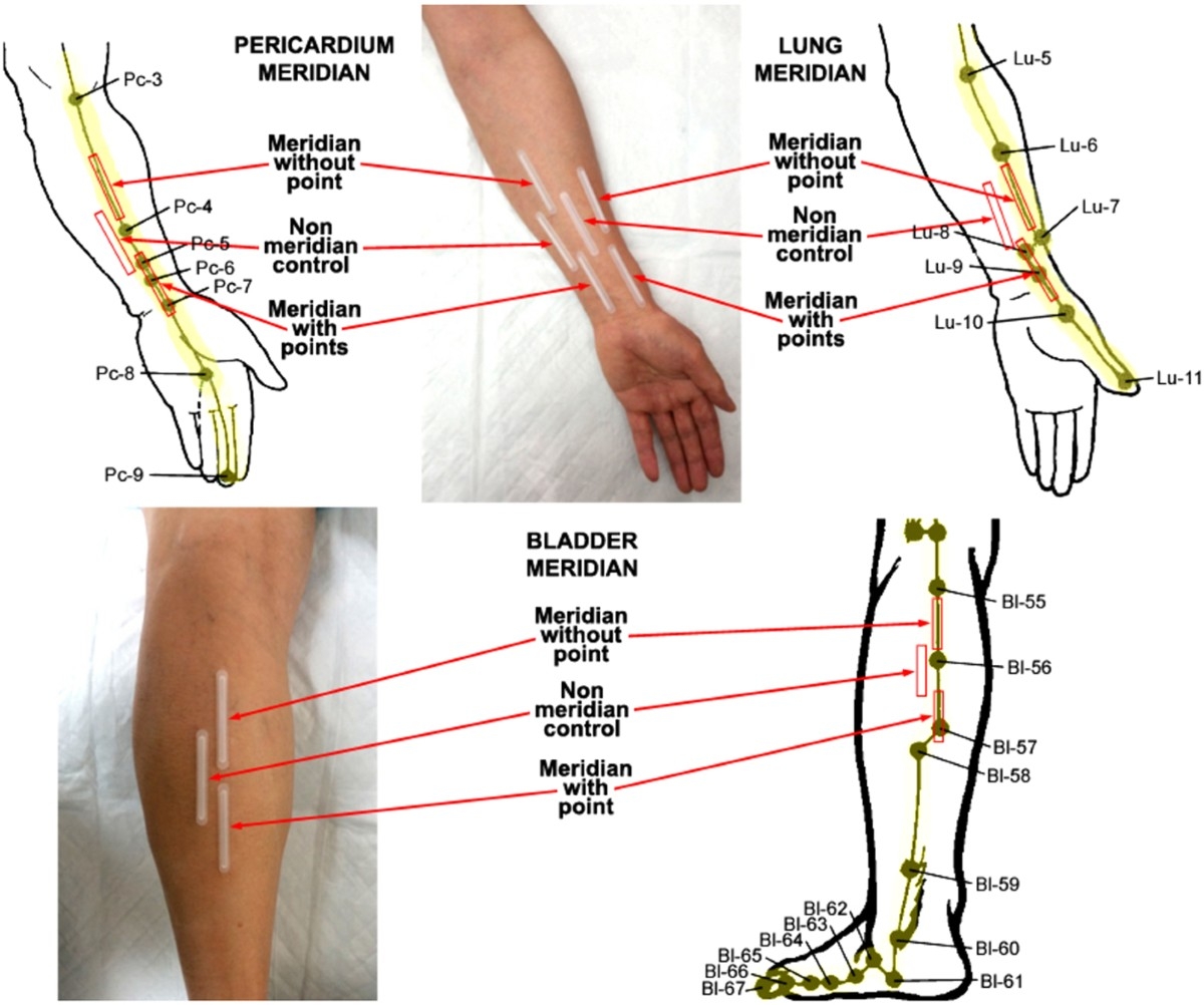 Influence Of Age Gender And Race On Nitric Oxide Release Over Acupuncture Points Meridians Scientific Reports