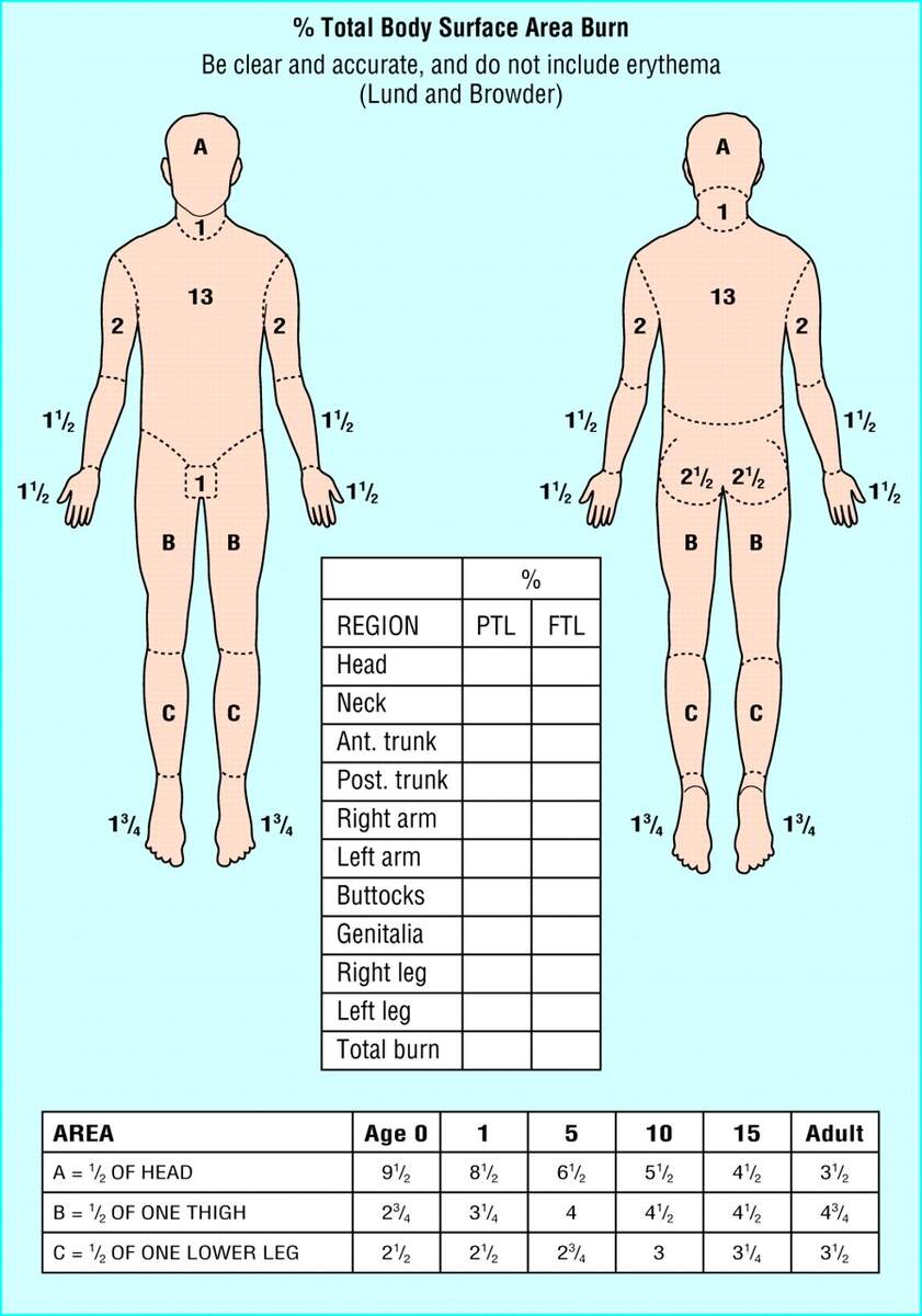 Initial Management Of A Major Burn II Assessment And Resuscitation The BMJ
