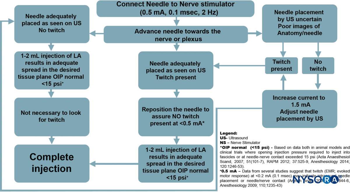 Introduction To Ultrasound Guided Regional Anesthesia NYSORA