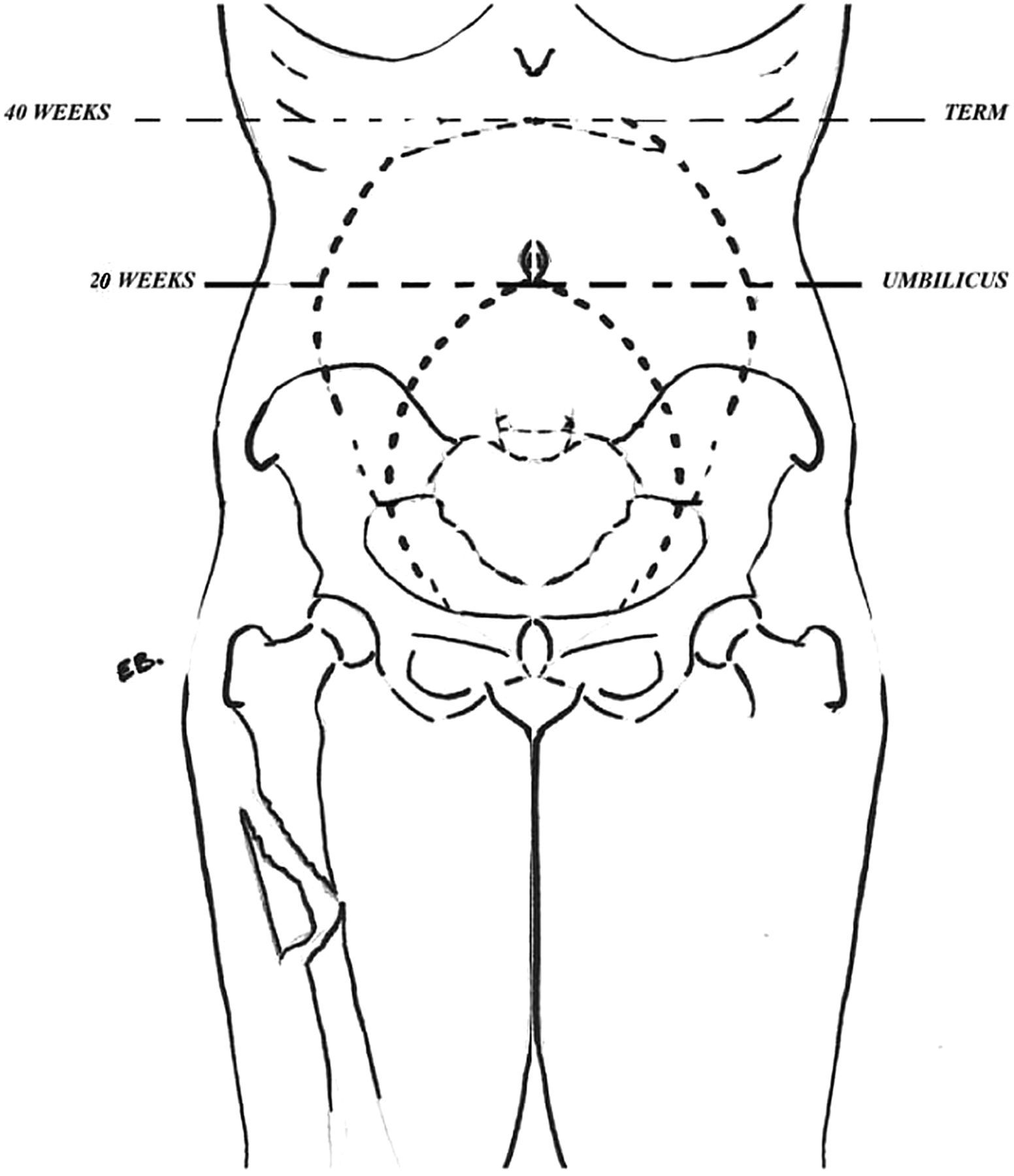 Frontiers Fertility Preservation In Pediatric Healthcare A Review