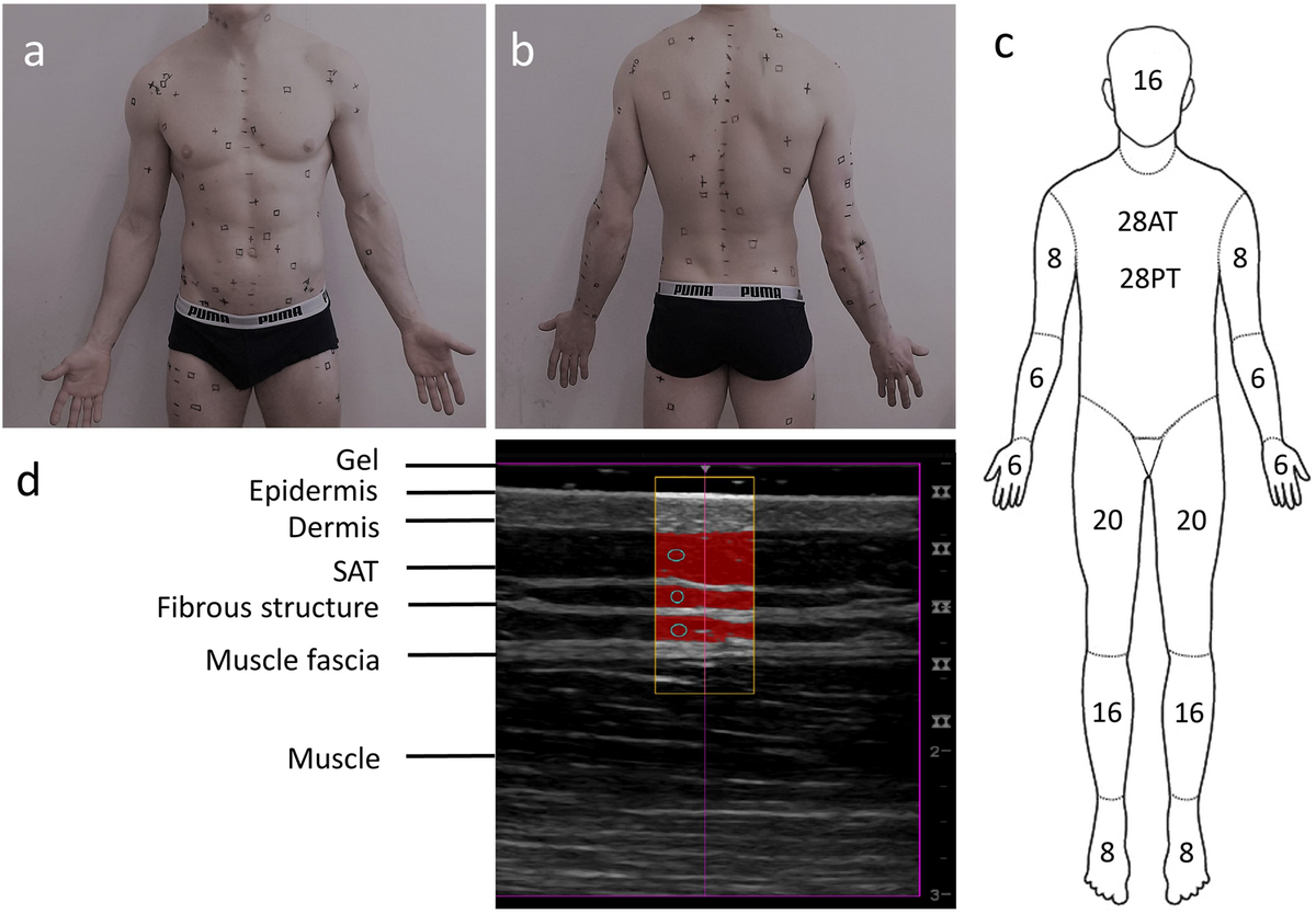 Measurement Of Mean Subcutaneous Fat Thickness Eight Standardised Ultrasound Sites Compared To 216 Randomly Selected Sites Scientific Reports
