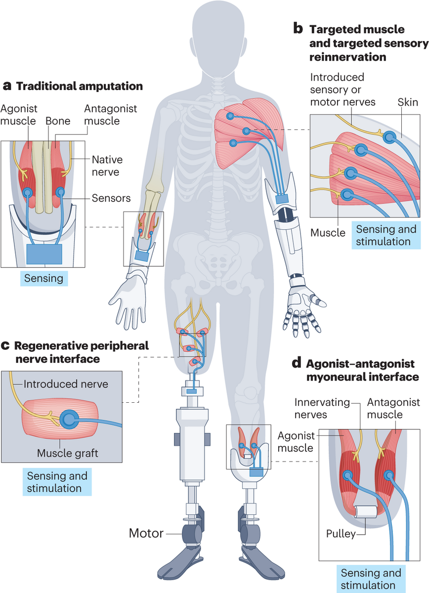 Mechanoneural Interfaces For Bionic Integration Nature Reviews Bioengineering