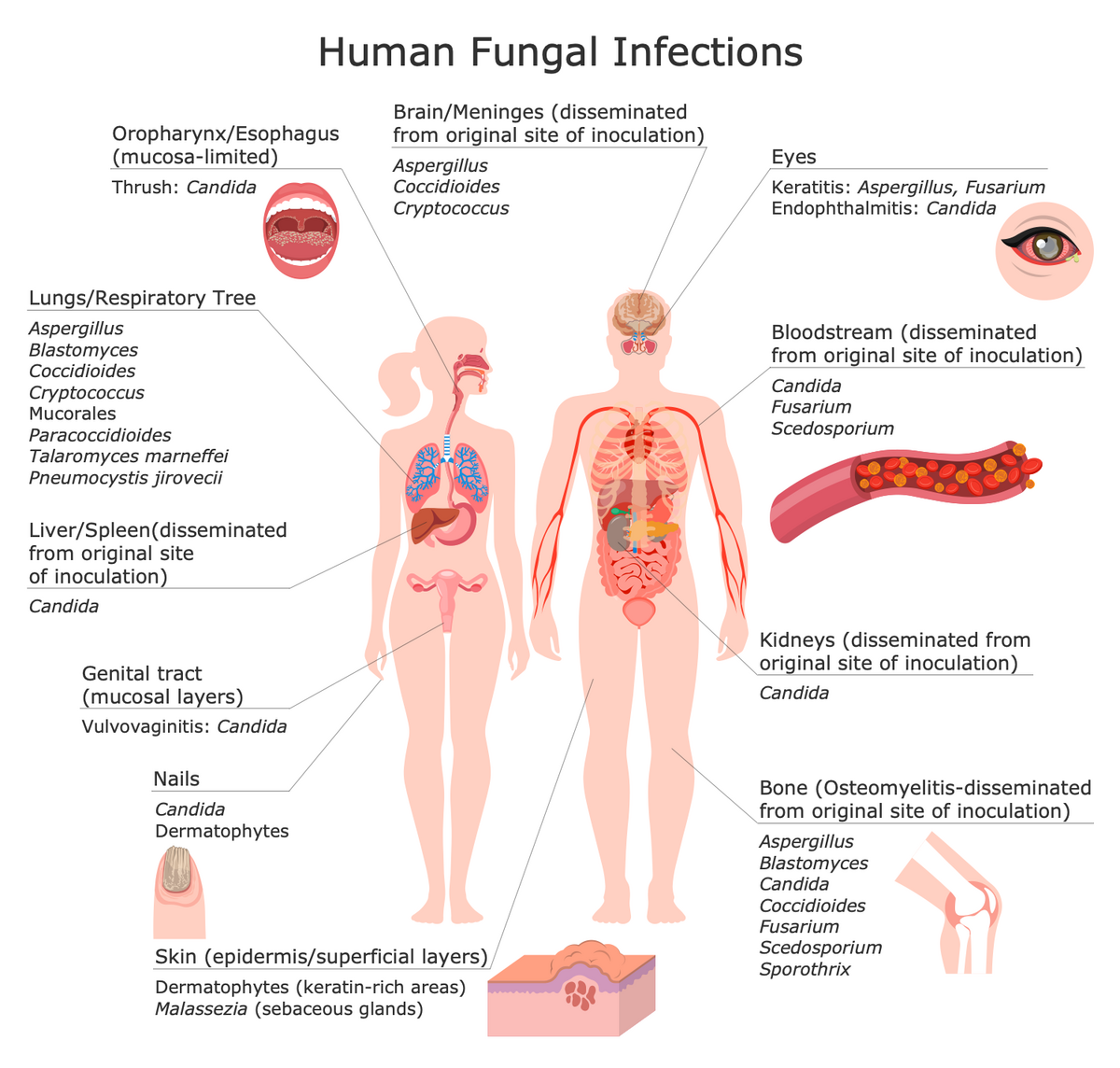Medical Mycology Solution ConceptDraw
