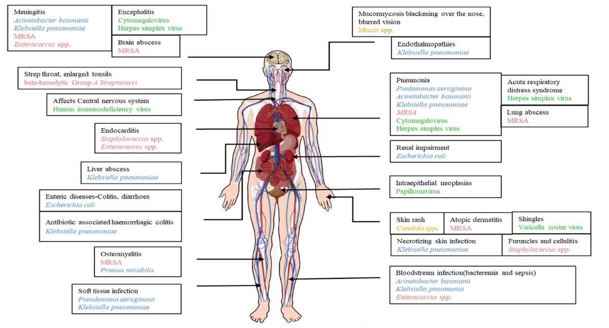 Microbial Infections In Burn Patients British Journal Of Nursing Cell And Body Tissue Physiology