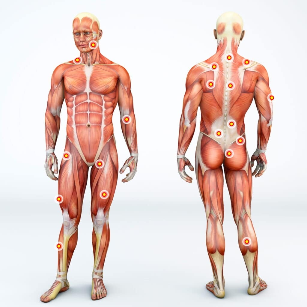 Most Common Trigger Points For Sciatica Sufferers In Lakewood CO PostureWorks Chiropractic Most Common Trigger Points For Sciatica Sufferers In Lakewood CO PostureWorks Chiropractic