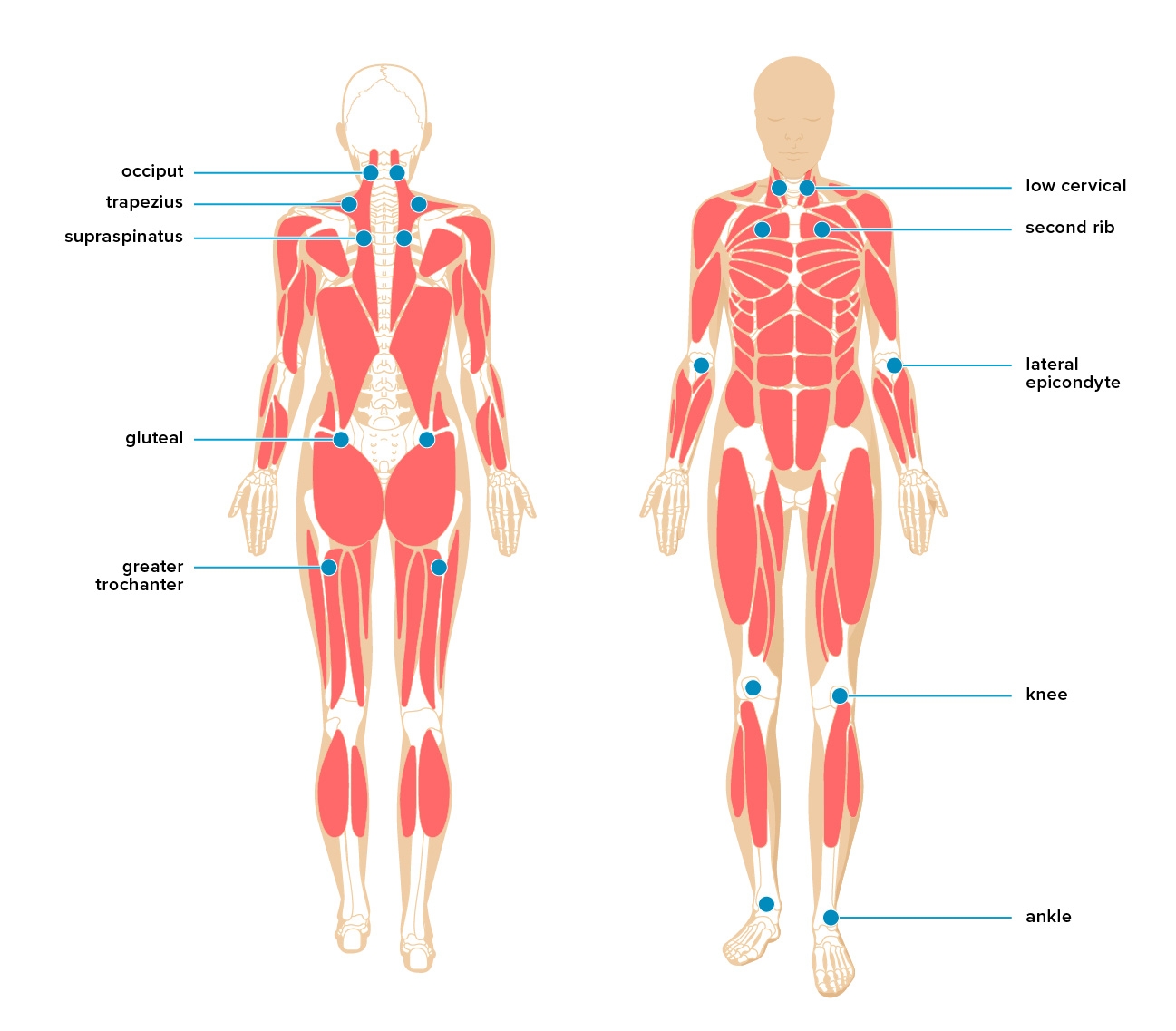 Myofascial Pain Treatment Symptoms Causes And More Myofascial Pain Treatment Symptoms Causes And More