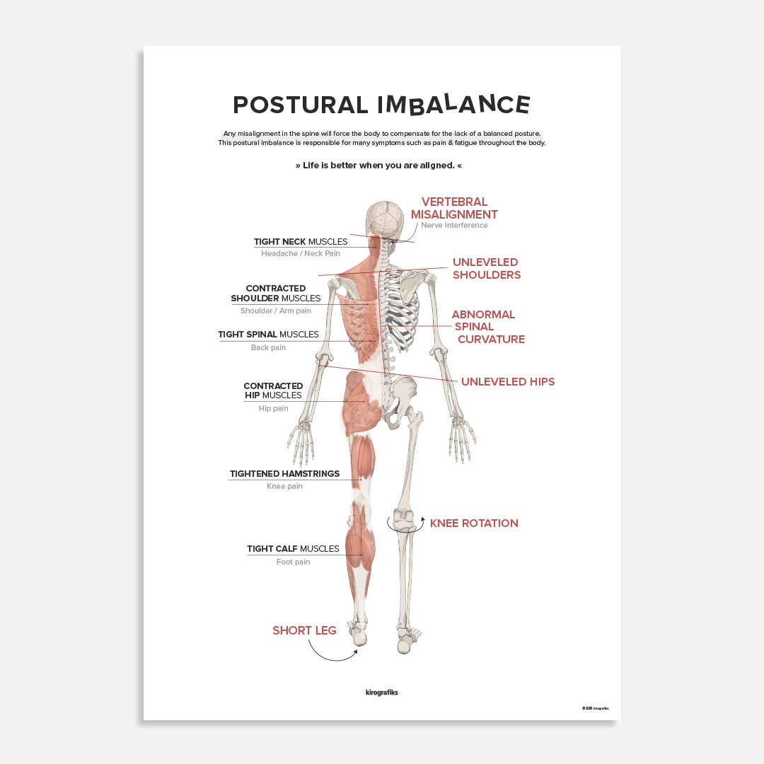 Postural Imbalance And Vertebral Subluxation Poster