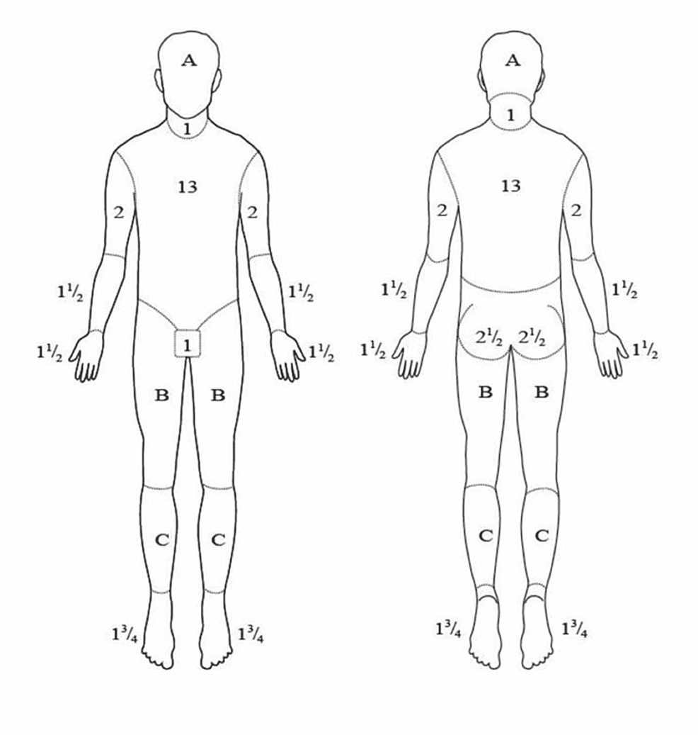 Prediction Of Mortality In Acute Thermal Burn Patients Using The Abbreviated Burn Severity Index Score A Single Center Experience Cureus Prediction Of Mortality In Acute Thermal Burn Patients Using The Abbreviated Burn Severity Index Score A Single Center Experience Cureus