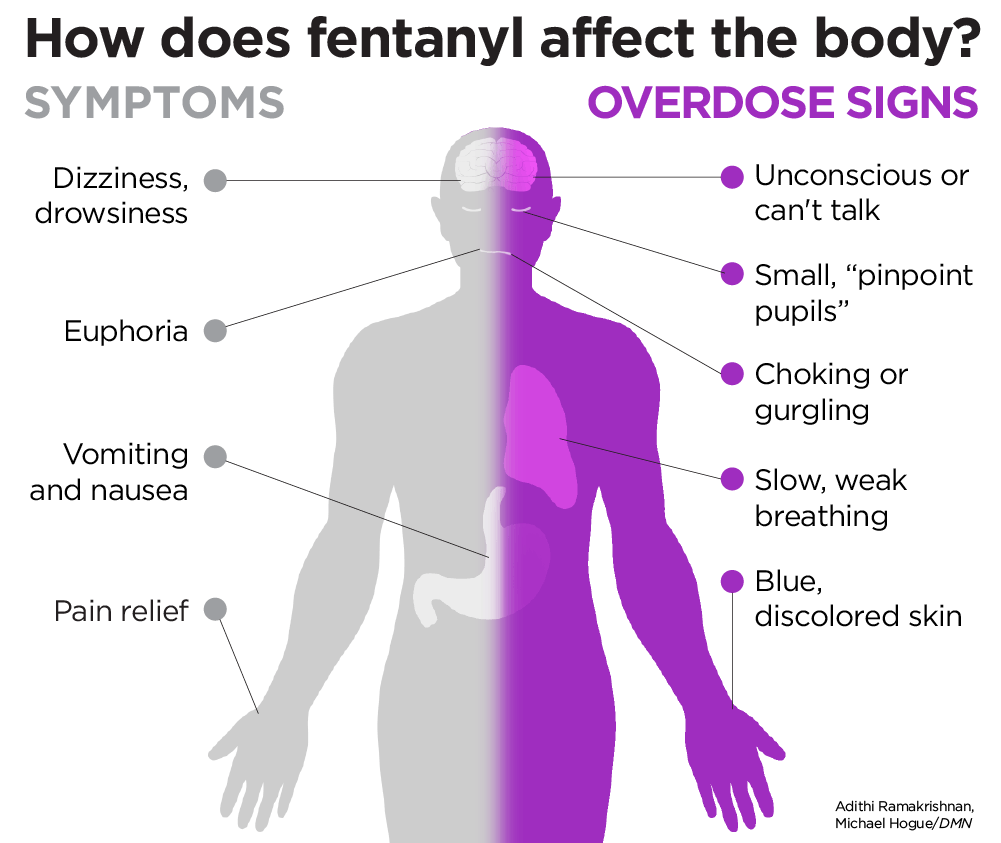 Q A What You Need To Know About Fentanyl Q A What You Need To Know About Fentanyl