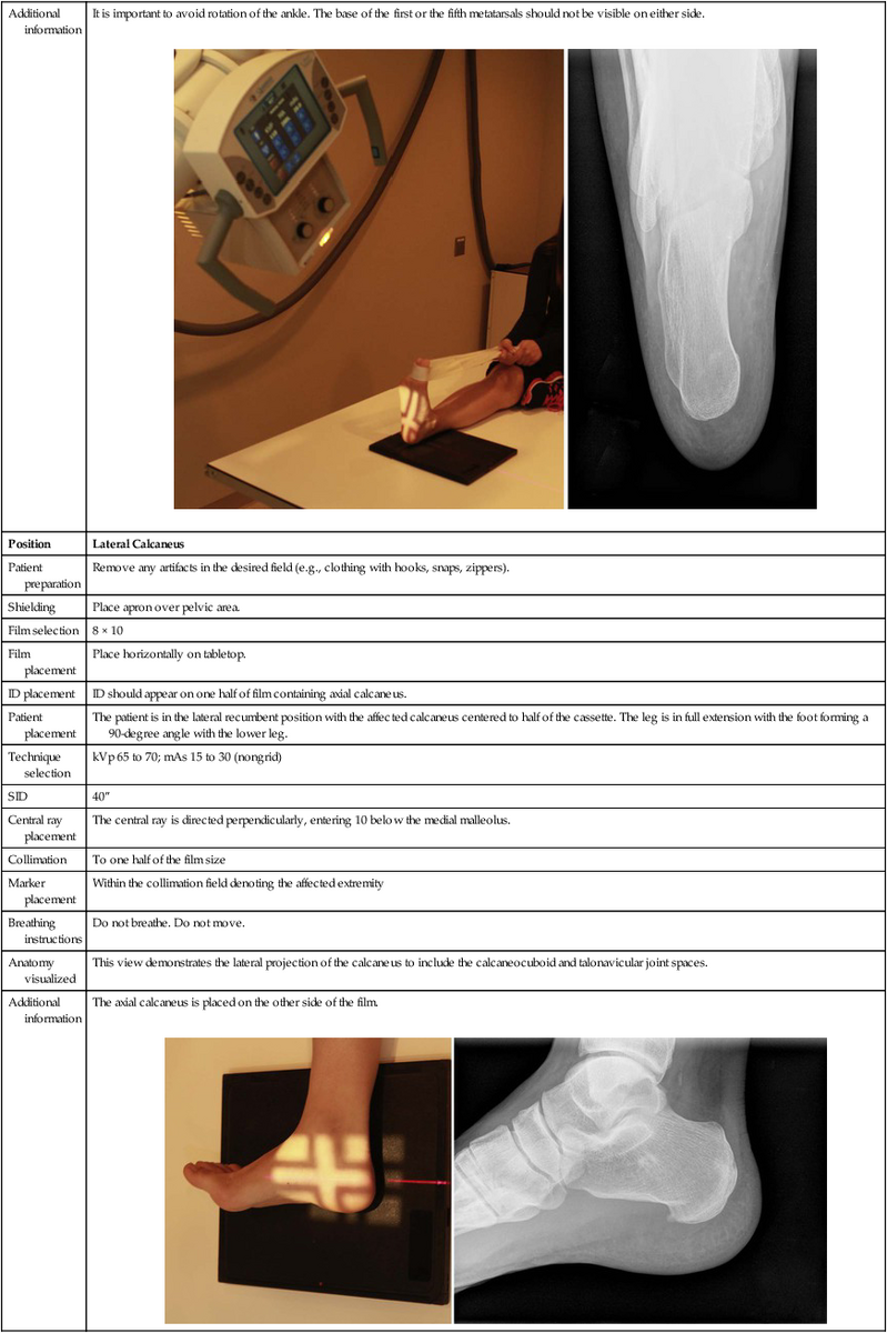 Radiographic Positioning Radiology Key Radiographic Positioning Radiology Key