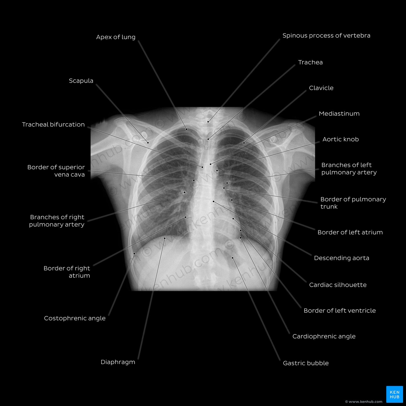Radiological Anatomy X Ray CT MRI Kenhub Radiological Anatomy X Ray CT MRI Kenhub
