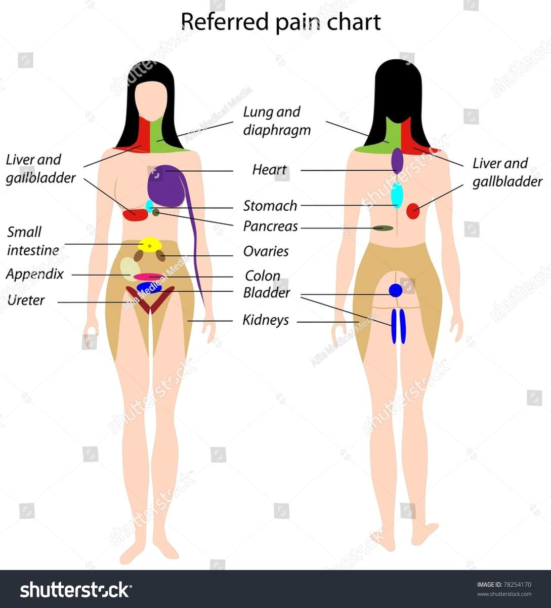 Referred Pain Chart Stock Illustration 78254170 Shutterstock Referred Pain Chart Stock Illustration 78254170 Shutterstock