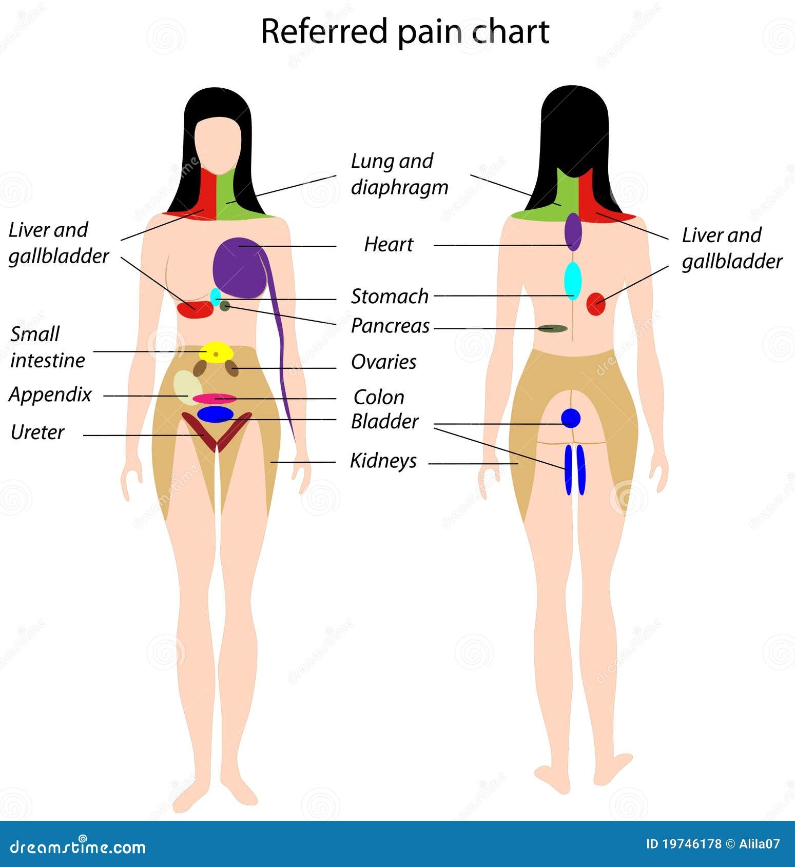 Referred Pain Chart Stock Vector Illustration Of Medical 19746178 Referred Pain Chart Stock Vector Illustration Of Medical 19746178