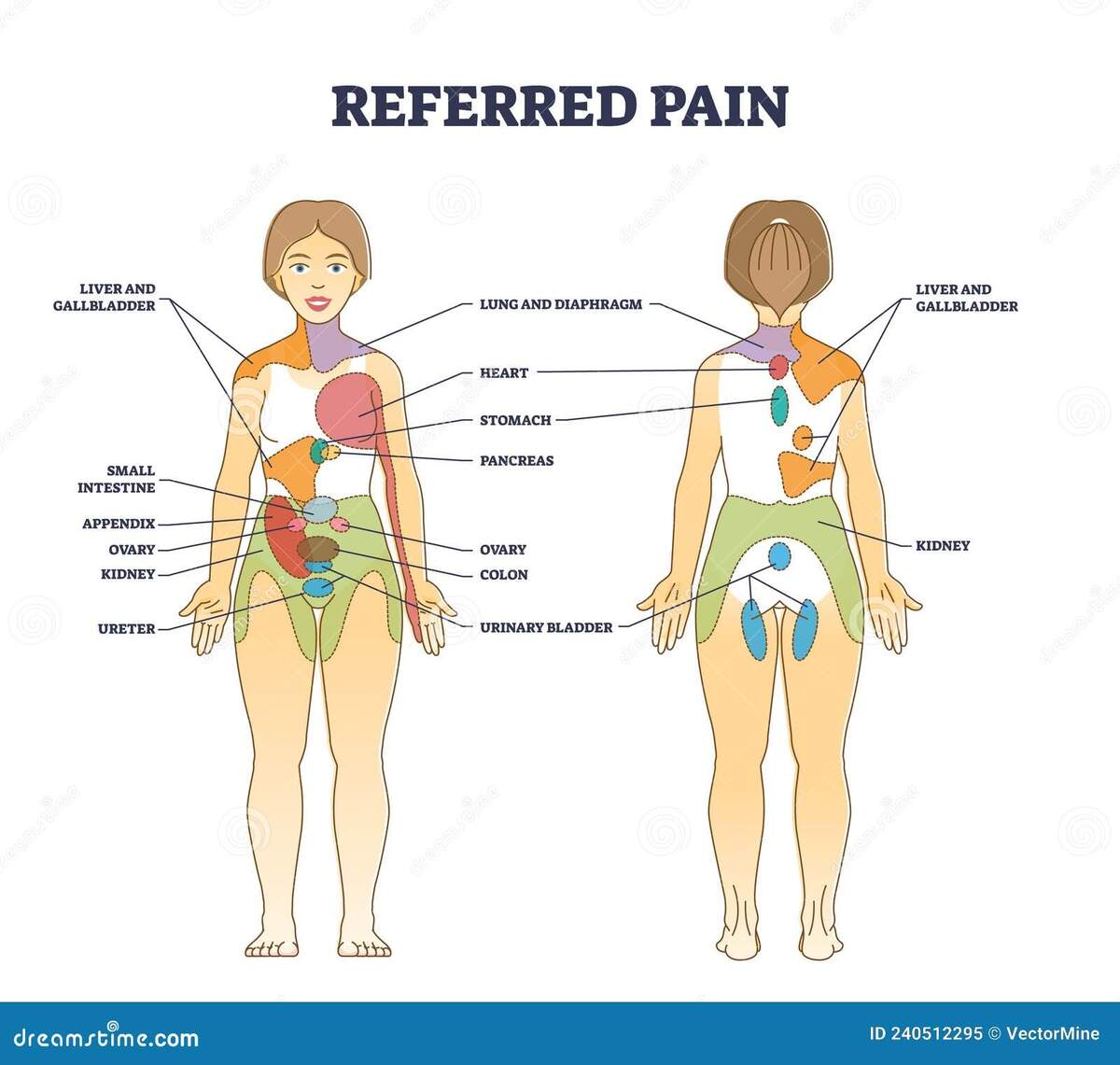 Referred Pain Location As Body Painful Stimulus Organ Origin Outline Diagram Stock Vector Illustration Of Diagnosis Healthcare 240512295