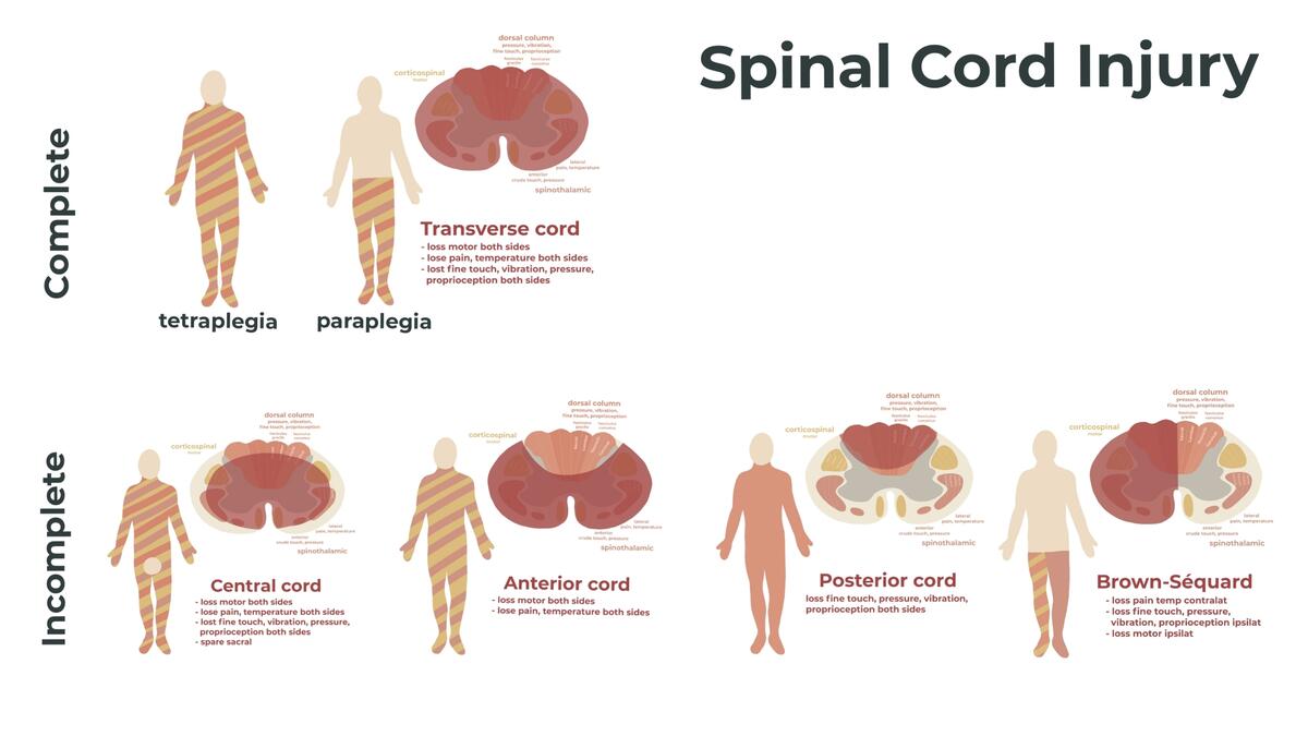 Spinal Nerves What They Are And What They Do Total Community Care