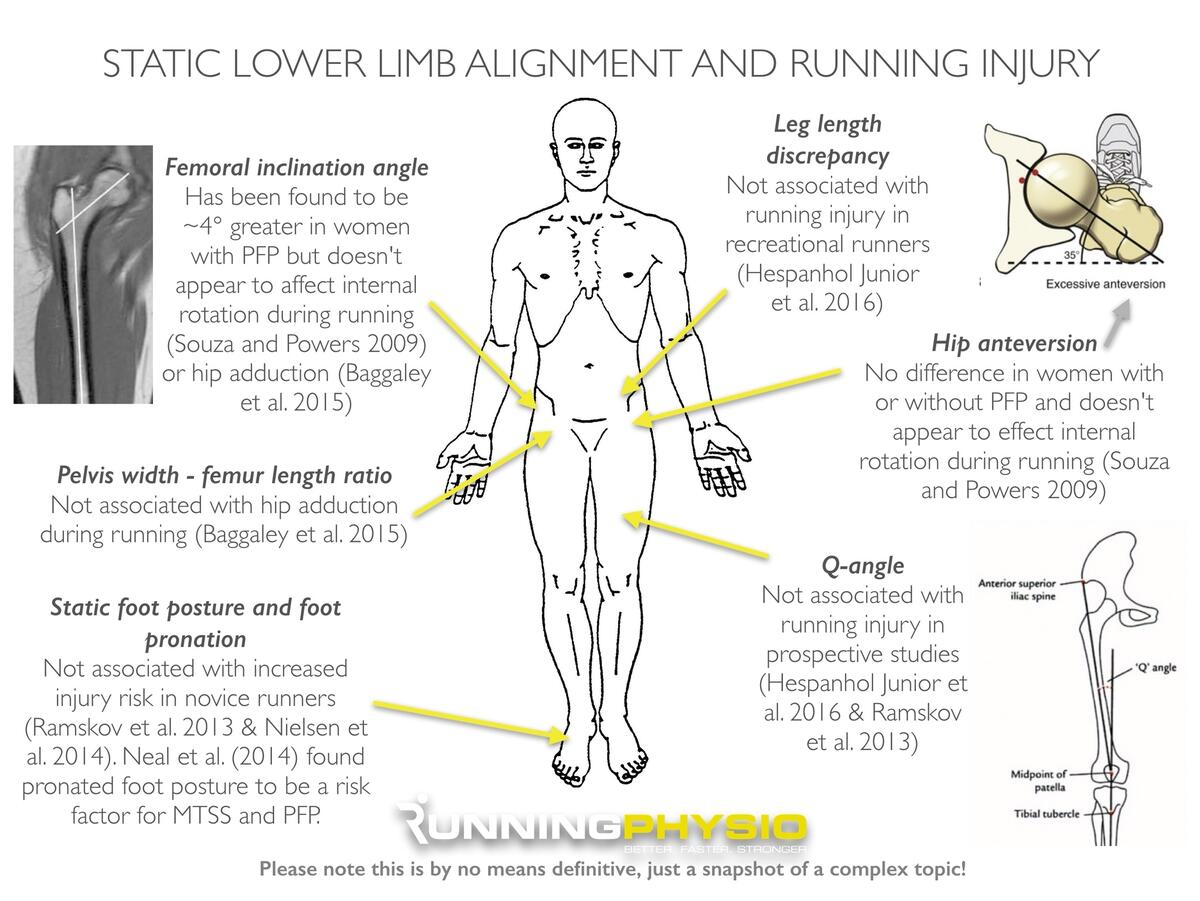 Static Alignment In Runners Are We Moving Forward By Standing Still RunningPhysio